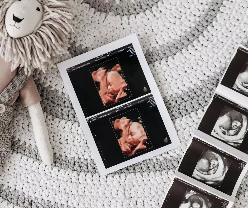 Badania w ciąży po 35 roku życia - blog helloskarbie.pl