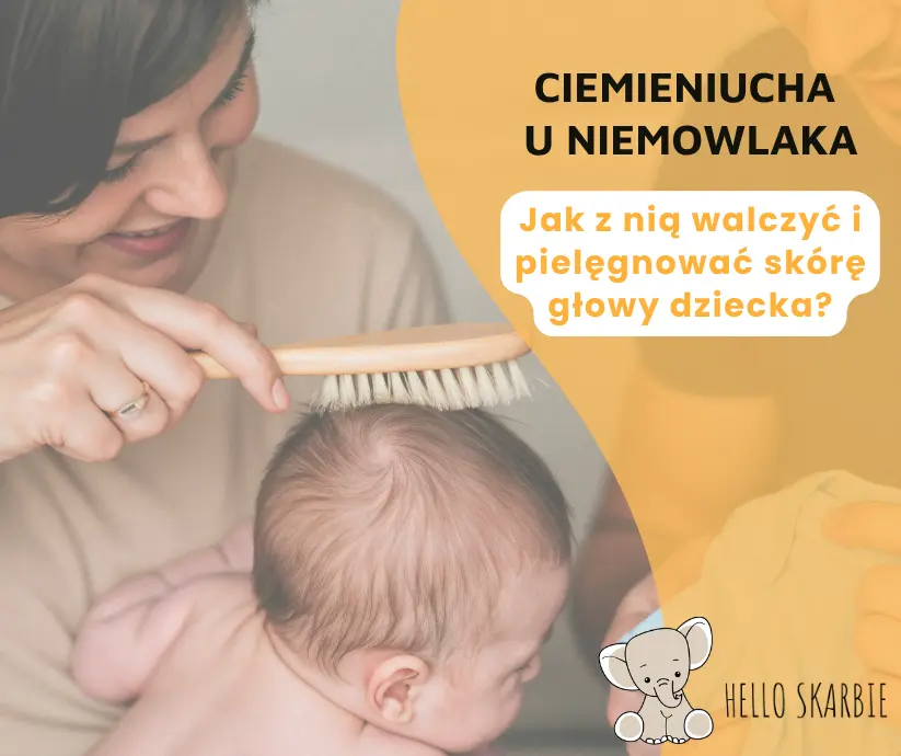 Ciemieniucha u niemowlaka - jak z nią walczyć i pielęgnować skórę głowy dziecka?
