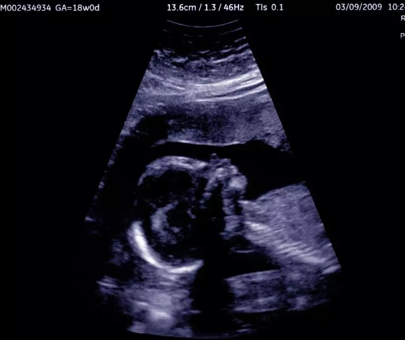 Rozwój płodu w czwartym miesiącu ciąży - blog helloskarbie.pl