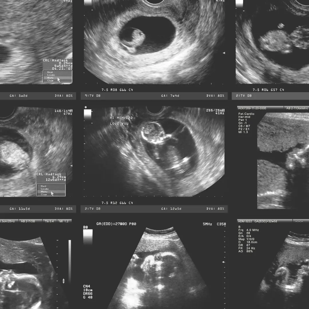 Zarodek w pierwszym tygodniu ciąży - blog helloskarbie.pl