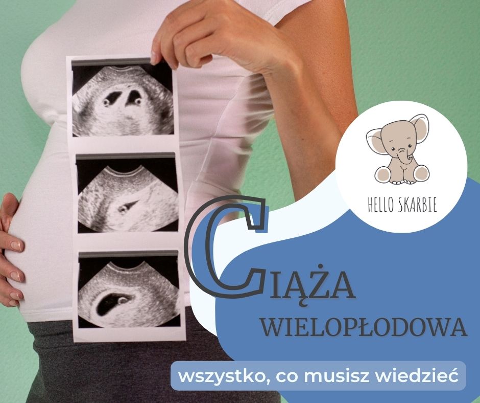 Ciąża wielopłodowa – wszystko co musisz o niej wiedzieć
