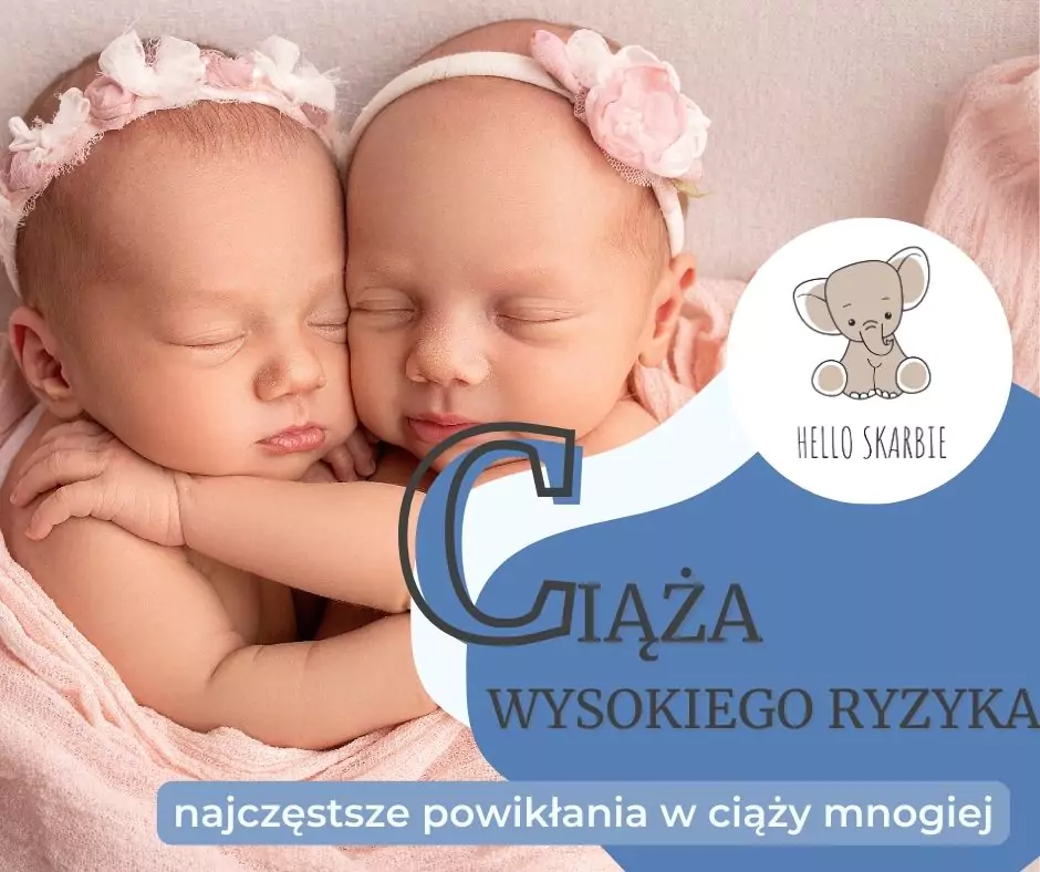 Czy ciąża bliźniacza to zawsze ciąża wysokiego ryzyka? Rozwiewamy wszystkie wątpliwości