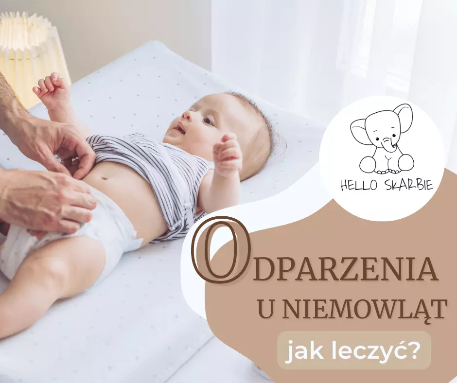 Jak leczyć odparzenia u niemowląt?